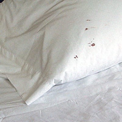bed-bug-pillow-stains